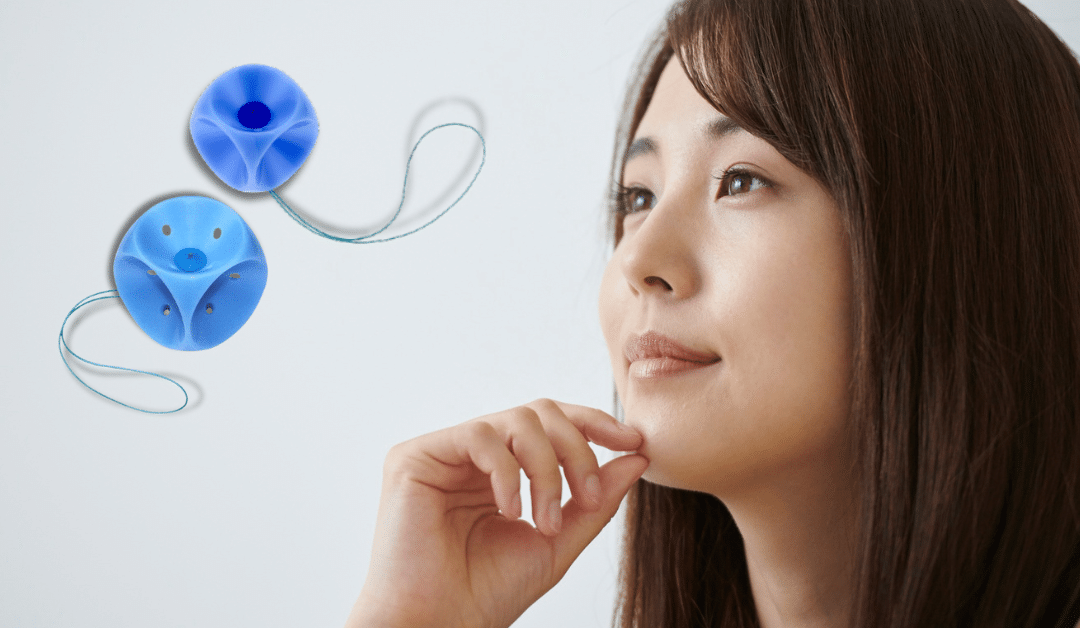 Pessaires : la solution méconnue contre la descente d’organes et les fuites urinaires ?